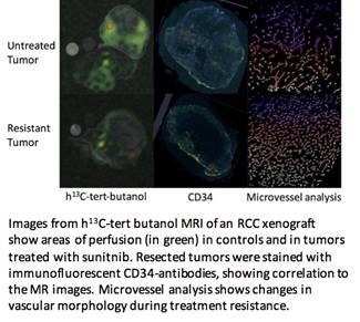 MRI of the Tumor Microenvironment