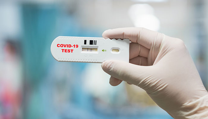  Xét nghiệm COVID-19