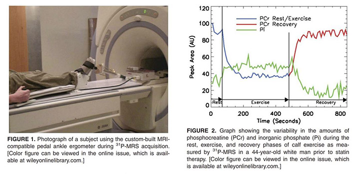 Subject using custom-built MRI-compatible pedal ankle ergometer during 31P-MRS acquisition