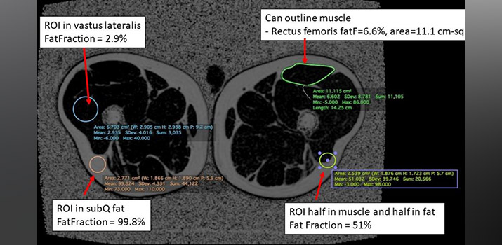Dixon imaging with fat quantification figures