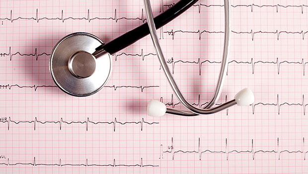 Heart Echocardiogram