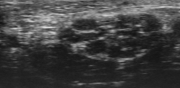  Vevo imaging system nerve visual